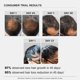 thumbnail image 5 of Sérum para el crecimiento del cabello Bare Anatomy Advanced 30 ml para mujeres y hombres, 5 of 8
