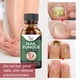 thumbnail image 5 of Anti Fungus Toe Repair Essence Onychomykose Paronychie Nagelpilz Behandlung Ndcxsfigh Cuidado Belleza, 5 of 8