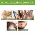thumbnail image 2 of Rosemary Oil For Hair And Scalp-hair Oil For Hair Loss To Stimulate Hair Growth With Castor Oil 50 Ml Yo, 2 of 5