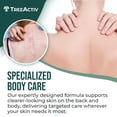 thumbnail image 2 of Spray para el tratamiento del acné TreeActiv Body & Back 240 ml con 2% de ácido salicílico, 2 of 7