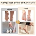 thumbnail image 6 of Electric Callus Remover for Feet - Start Makers Rechargeable Pedicure Tools for Feet, Portable Foot Scrubber for Men and Women, Ideal Gift for Birthdays, Anniversaries, Festivals, 6 of 6