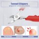 thumbnail image 2 of Ofertas únicas Cortaúñas para uñas gruesas, uñas encarnadas para hombres, personas mayores, cortaúñas encarnadas, color rojo, 2 of 7
