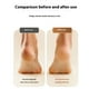 thumbnail image 5 of Dispositivo de pedicura Soidarity ABS desmontable cuidado de los pies gris, 5 of 6