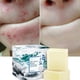 thumbnail image 3 of Jabón para eliminar ácaros, jabón Facial rico en sal marina, reparación rápida de ácaros, limpieza nutritiva, 2 uds., 3 of 5