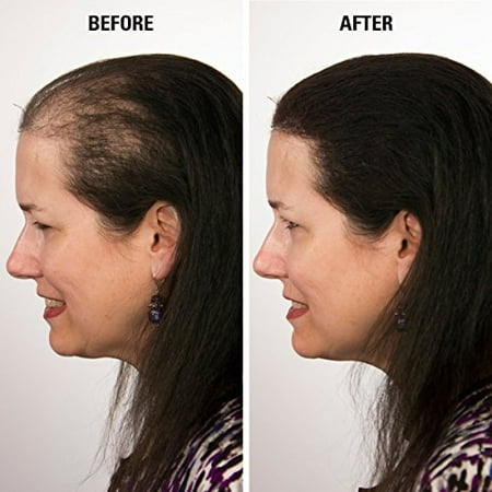 Eclipse Hair Building Fibers Beard Filler Instant Hair Fillers
