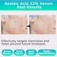 thumbnail image 3 of Sérum CELDYQUE Ácido azelaico 12% con ácido tranexámico 30 ml, 3 of 7