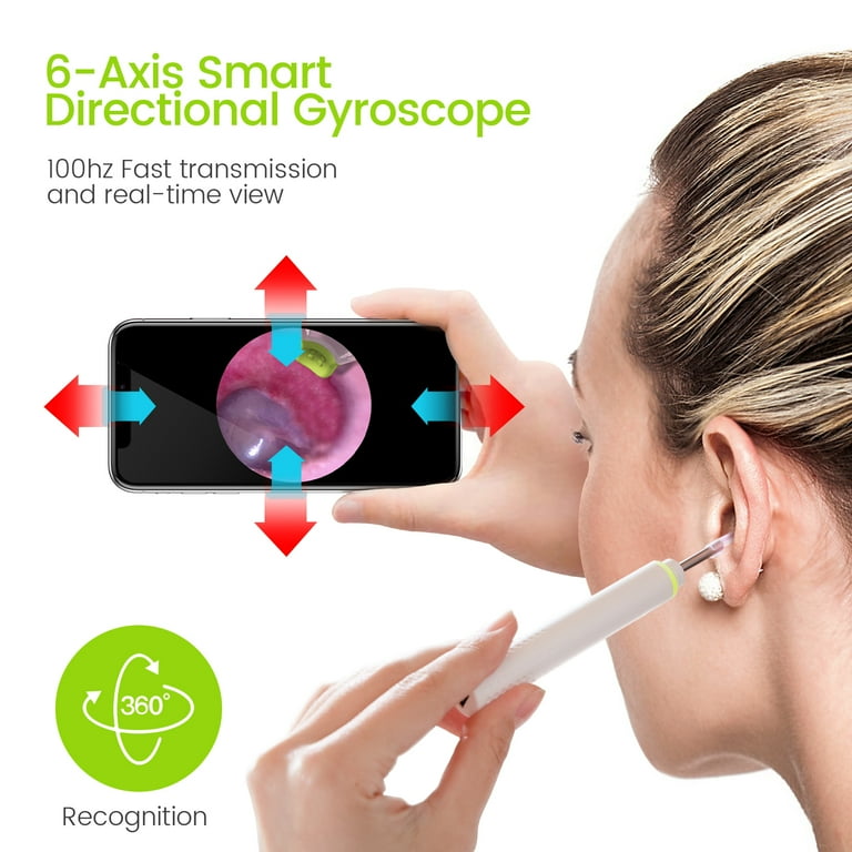 Scopearound Ear Wax Removal Tools Otoscope Ear Cleaning Camera with 6 Adjustable LED Lights Compatible with iPhone Android and Tablet Walmart
