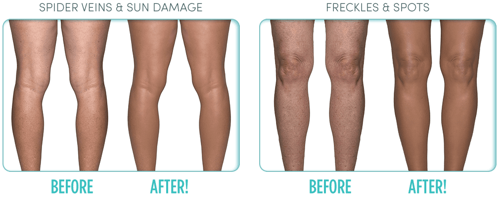 ideal conceal walmart