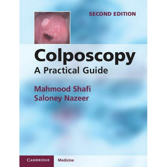 Colposcopy, (Paperback)