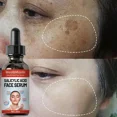 thumbnail image 4 of Suero Facial de niacinamida, ácido salicílico, productos hidratantes para el cuidado de la piel, 2024, 4 of 5