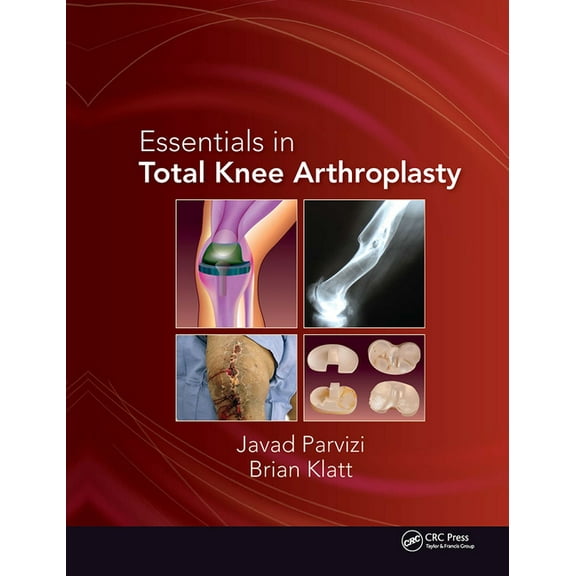 Essentials in Total Knee Arthroplasty, (Hardcover)