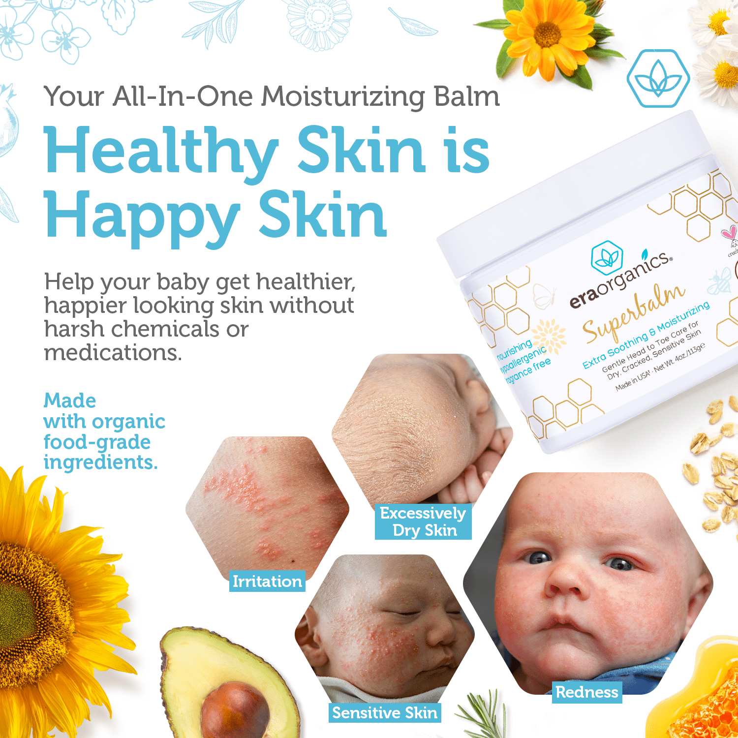 Era Organics Healing Ointment for Babies - USDA Certified Organic Natural Gentle Moisturizer for Sensitive Skin Prone To Baby Eczema, Cradle Cap, Rashes, Hives & More Super Balm 4 Ounce