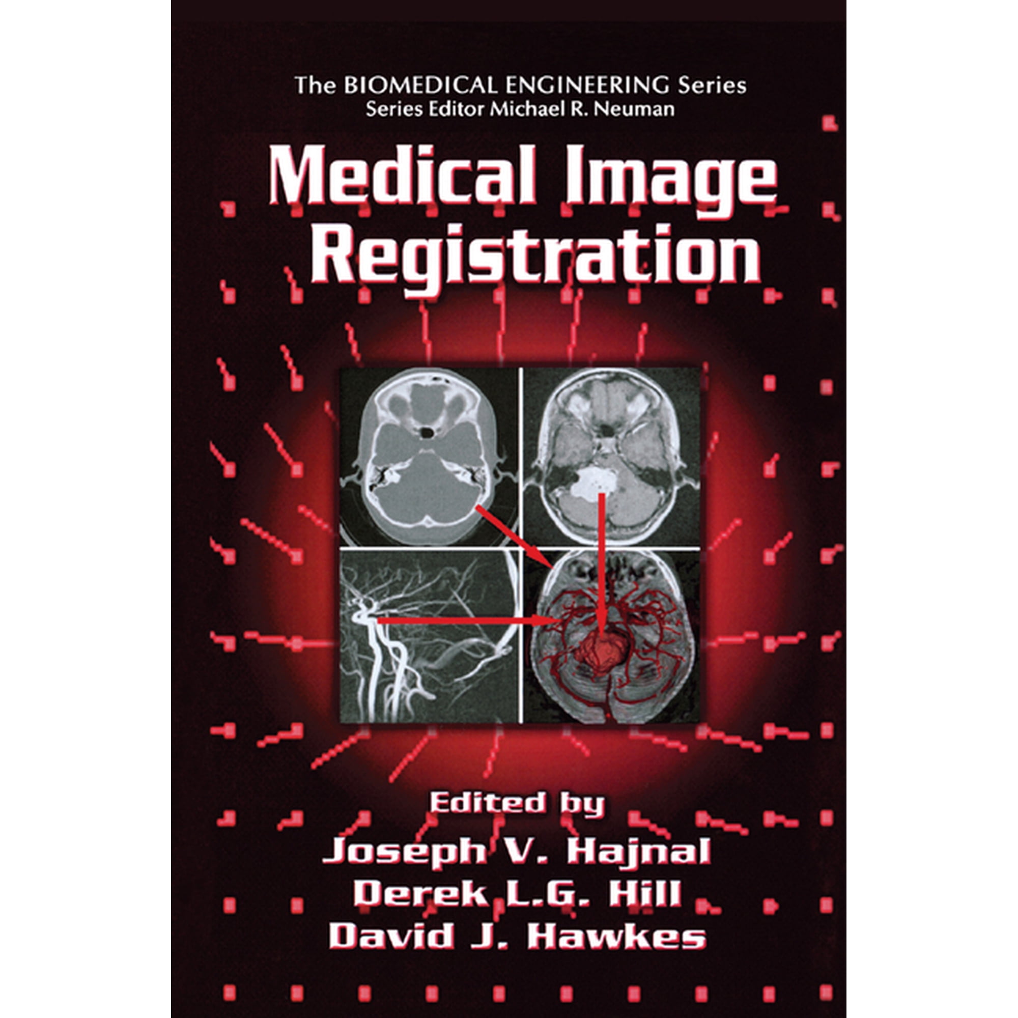 Medical Image Registration (Paperback)