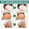 thumbnail image 4 of Tratamiento De Limpieza De Espinillas En Los Glúteos, Crema Reparadora De La Piel De Los Glúteos Para Limpieza De Poros De 100 Ml Para El área Del Muslo Para Uso Diario, 4 of 7
