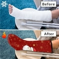 thumbnail image 7 of COEQINE Christmas 2 Pcs Leg Cast Cover Santa Claus Below The Knee Leg Cast Sleeve-M Breathable Cast and Bandage Protector Broken Leg Shower Cast Cover Christmas Gifts for Friends Family, 7 of 7