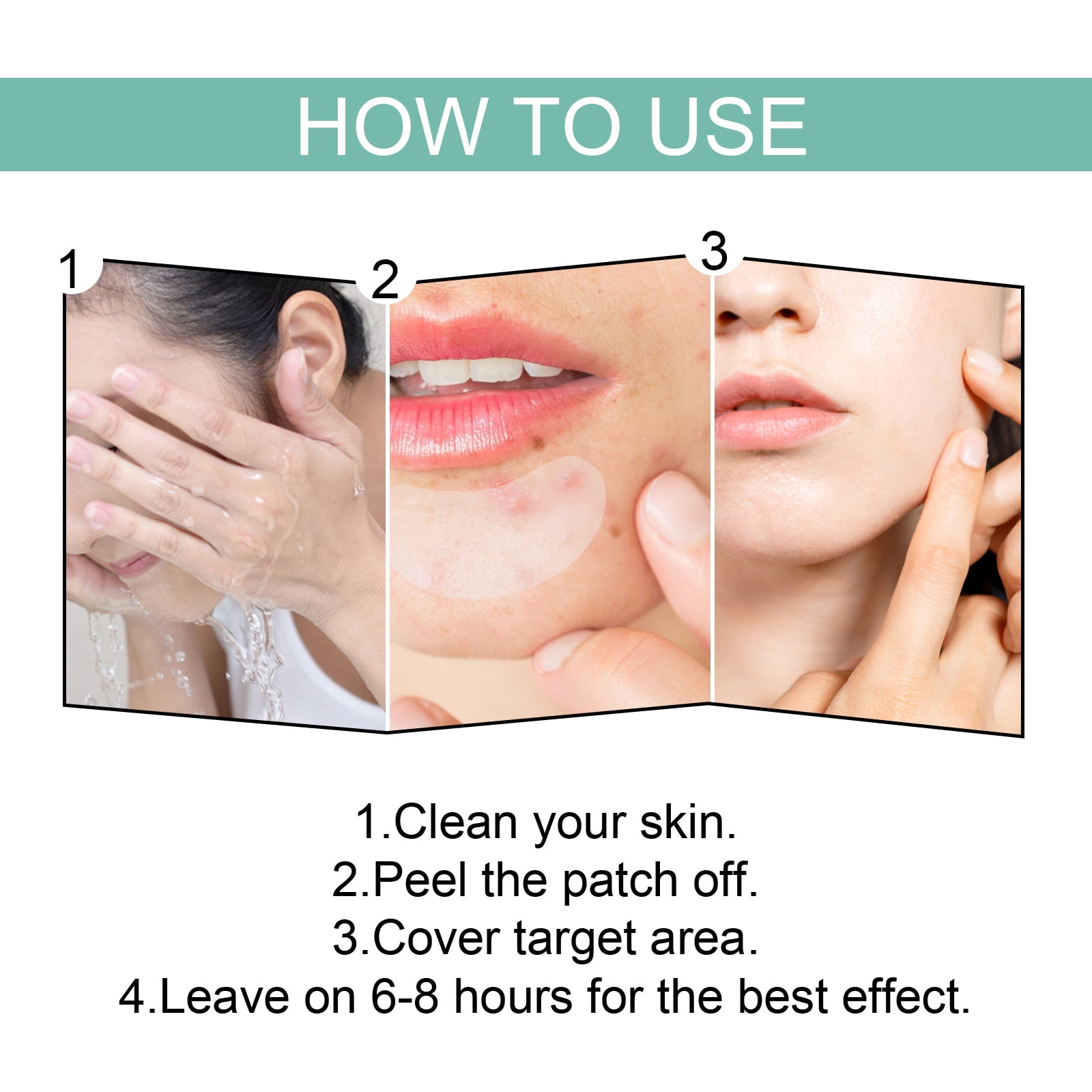 Alvantor Acne Patches Hydrocolloid Pimple Patches for Face, Zit Cover Invisible Spot Stickers, 132Patches