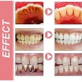 thumbnail image 4 of Sp 10 Toothpaste, Sp-10 Toothpaste, Ultra Whitening Toothpaste Sp-10, Sp-10 Probiotic Brightening Whitening Toothpaste, Fresh Breath, 4 of 5