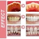 thumbnail image 4 of Sp 10 Toothpaste, Sp-10 Toothpaste, Ultra Whitening Toothpaste Sp-10, Sp-10 Probiotic Brightening Whitening Toothpaste, Fresh Breath, 4 of 5