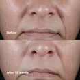 thumbnail image 4 of Crema facial Clinique Smart Clinical Repair Wrinkle 50 ml, 4 of 7