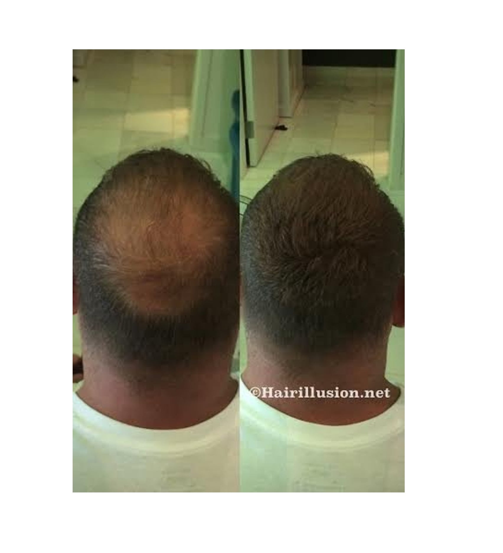 HAIR ILLUSION - 100% Real Human Hair Fibers - Not Synthetic - For Men & Women, Premium Hair Building Formulation, Brown - 18g