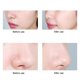 thumbnail image 3 of depurador de piel ultrasónico, 4 En 1 Ultrasónico Facial Skin Scrubber, Dispositivo De Limpieza De La Piel Facial, Masajeador De Elevación Y Limpio Para Eliminación De La Espinilla Y Limpiador De Poro Khall 1.4122E+12, 3 of 6