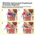 thumbnail image 4 of Nose Sinusitis Rhinitis Cure Therapy Massage Infrared Pulse Laser Treatment Device, 4 of 5
