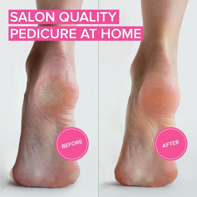 Megafile Foot File Rasp removes hard skin on feet, Callus Scraper Feet