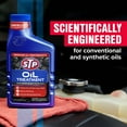 thumbnail image 4 of STP High Viscosity Oil Treatment (15 fluid ounces), 4 of 15