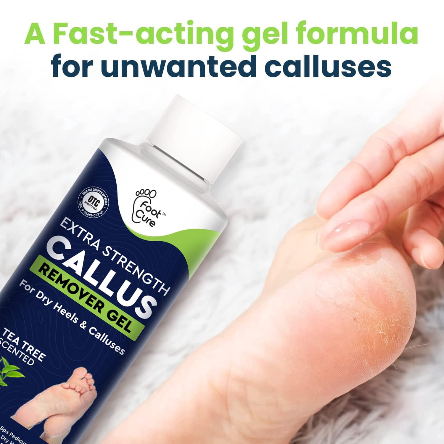 Foot Cure Callus Remover Gel - 2Pcs Strength Foot Callus Remover Gel with Pumice Stone for Dead Skin, Pedicure Spa Tools(16oz)