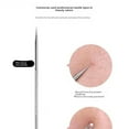 thumbnail image 4 of 1Pcs Stainless Steel Acne Needle Blackhead Removal Pimple Extractor Pin Blemish, 4 of 6