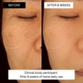 thumbnail image 2 of Kit Coreano Radiance Plan Solución para Manchas Oscuras 3 Pasos, 2 of 9