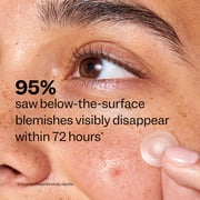 (3 pack) Peach Slices Deep Blemish Microdarts, Below-the-Surface Pimple Patches, 9 Ct