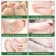 thumbnail image 4 of Paquete de 3 exfoliantes para pies, agente exfoliante natural, utilizado para piel seca, callos, reparación de talones ásperos, suaviza los pies y consigue una piel suave, 4 of 4