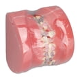 thumbnail image 4 of Modelo Dental de Ortodoncia NikouMX Resina, 4 of 8