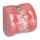 thumbnail image 4 of Modelo Dental de Ortodoncia NikouMX Resina, 4 of 8