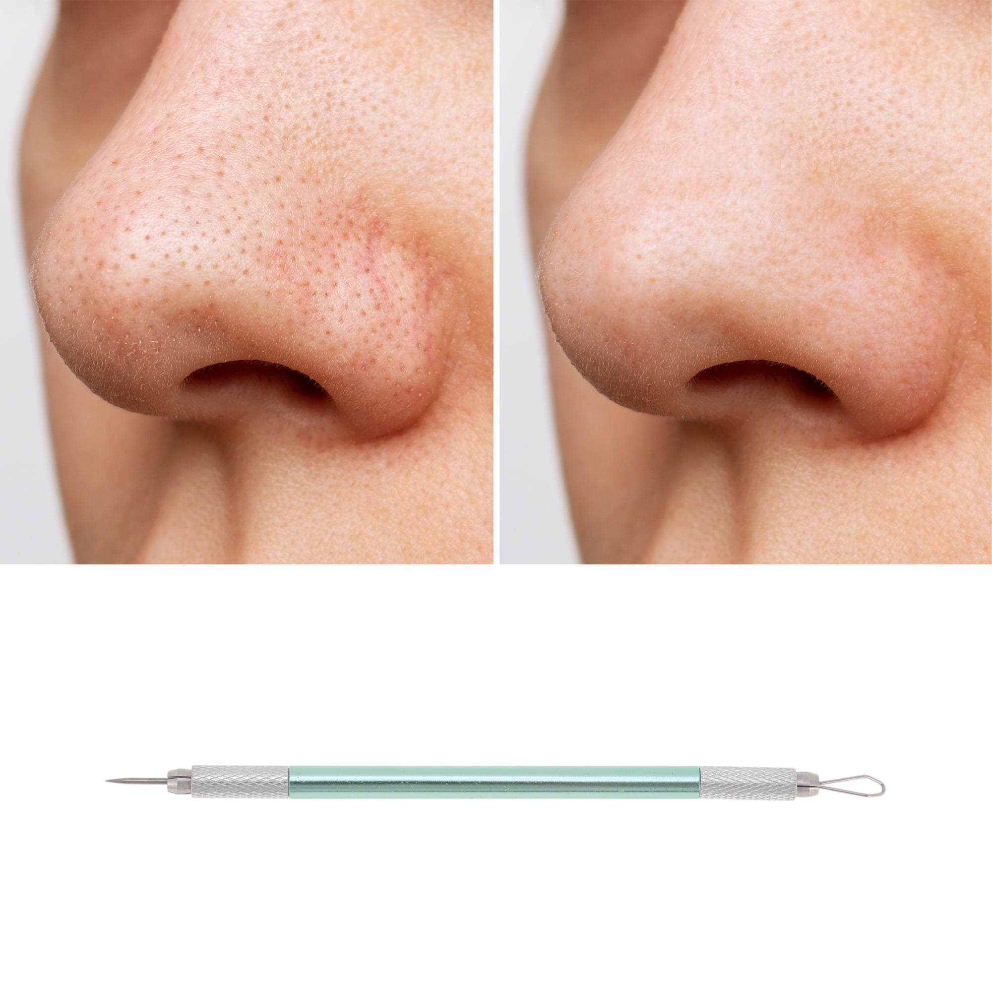 Unique Bargains Convenient Double-Ended Pimple Extractor 1 Pc Green