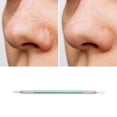 thumbnail image 5 of Unique Bargains 1 Pc Convenient Double-Ended Pimple Extractor Green, 5 of 7