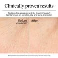 thumbnail image 6 of Neutrogena Hydro Boost Daily Gel Cream, 1.7 fl oz and Hydrating Gel Cleanser, 0.5 fl oz, 6 of 9