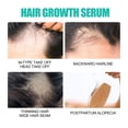 thumbnail image 3 of essence de Cheveux Épais Répare et Hydrate Cheveux Secs et Frisés pour Prévenir la Perte de Cheveux et Renforcer les Cheveux pour les Rendre Plus Épais, 3 of 5