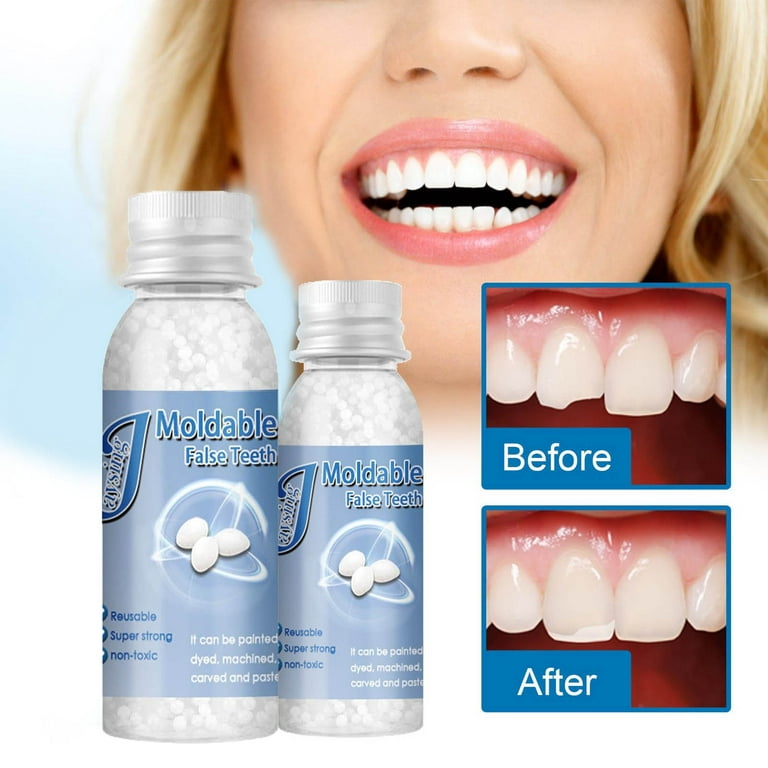 Leaveforme 10ml/20ml/30ml False Teeth Gel Moldable Temperature Resistance  DIY Filling Missing Broken Tooth Repair Beads for Adult 