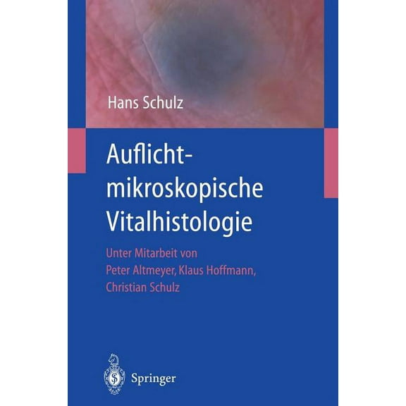 Auflichtmikroskopische Vitalhistologie: Dermatologischer Leitfaden, (Paperback)