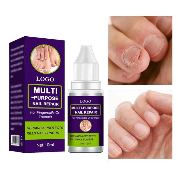 Fungal Nail Repair Essence Serum Care Treatment Foot Nail Fungus