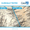 thumbnail image 5 of CeraVe Hydrating Anti-Dandruff Conditioner for Flakey Itchy Scalp 9 fl oz, 5 of 10
