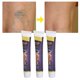 thumbnail image 5 of Crema Para Aliviar Las Venas Varicosas, Aumentar La Circulación Sanguínea, Reducir El Dolor, Reparar 3 Piezas De Crema Para Venas Varicosas Para Vasculitis, 5 of 7