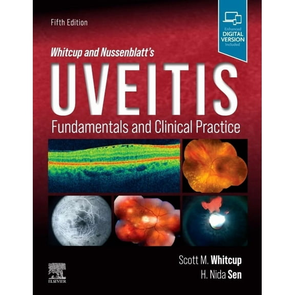 Whitcup and Nussenblatt's Uveitis: Fundamentals and Clinical Practice, (Hardcover)