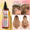 thumbnail image 5 of Super Blend of Pure Rosemary Oil for Hair Growth with Black Castor, Batana, Argan, Jojoba, Infused with Keratin & Biotin, Blend Scalp and Hair Oil for Hair Strengthening, Moisture, Shine, Protection, 5 of 7