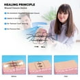 thumbnail image 3 of Kit de emergencia Greetmed con tiras para cerrar heridas, punto de cremallera, 6 unidades, 3 of 9