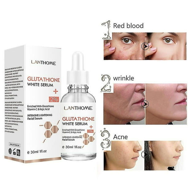 glutathione can cause skin cancer Application of glutathione depletion in cancer therapy: Enhanced ROS-based  therapy, ferroptosis, and chemotherapy