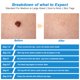 thumbnail image 4 of Kit De Eliminación De Etiquetas De Piel, Equipo De Eliminación De Verrugas Lunares Automático, Herramienta De Cuidado De La Belleza De La Piel Para El Cuerpo De La Cara Speravity CE007011-00, 4 of 6