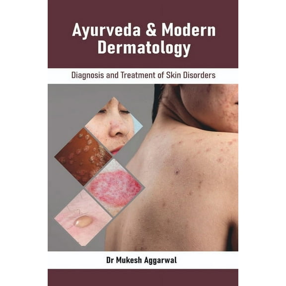Ayurveda & Modern Dermatology: Diagnosis and Treatment of Skin Disorders, (Paperback)
